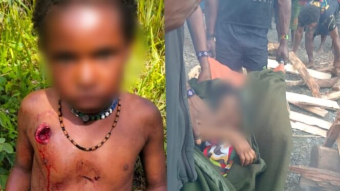 
OPINI | Peluru di Dada Aliko, Trauma di Tubuh Generasi Papua