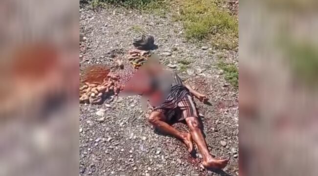 Seorang ibu yang diduga terkena bom di Intan Jaya. (Foto: Istimewa)