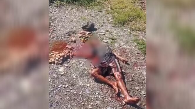 
Seorang ibu yang diduga terkena bom di Intan Jaya. (Foto: Istimewa)